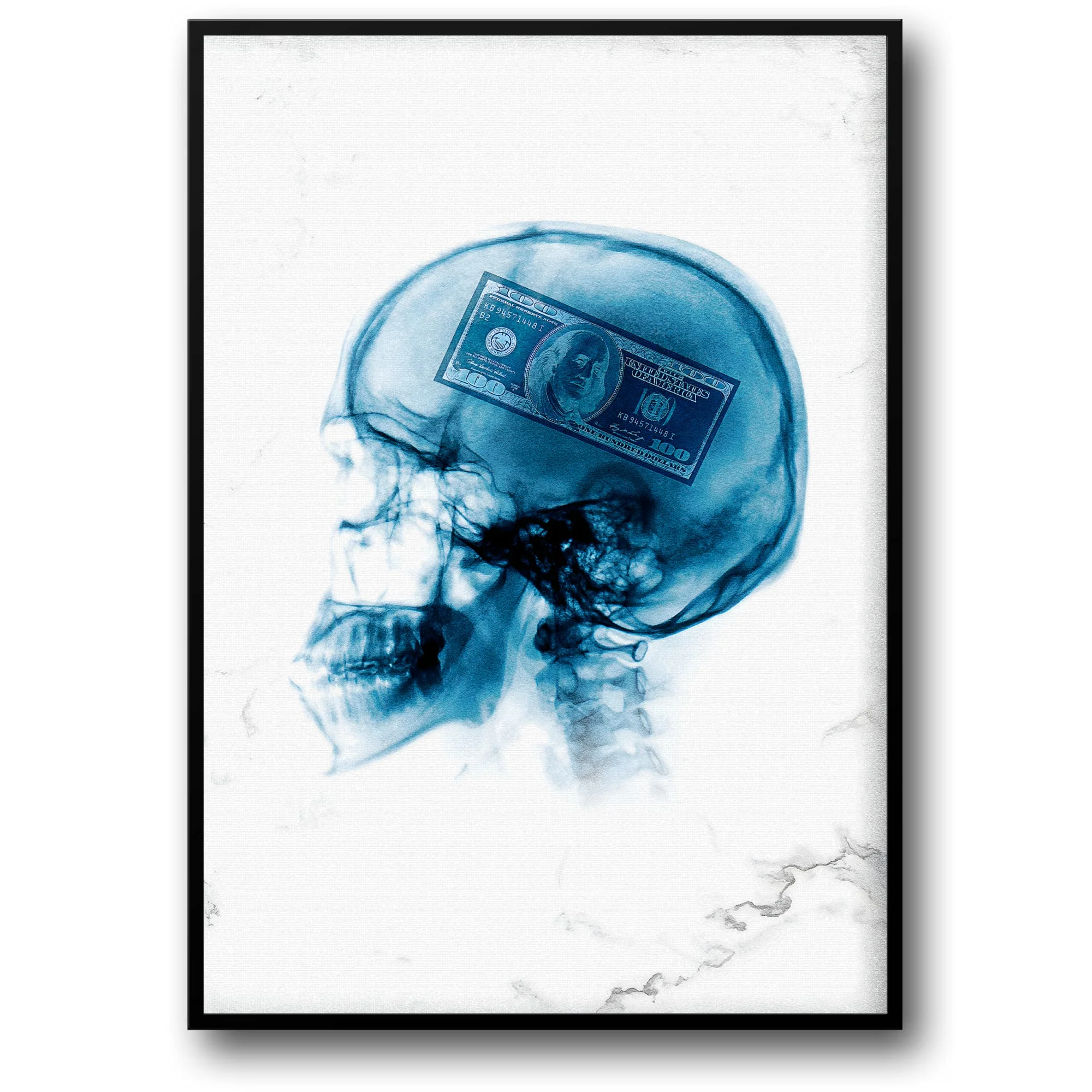 X-Ray Art | Human Skull & Dollar | Modern Money Mindset
