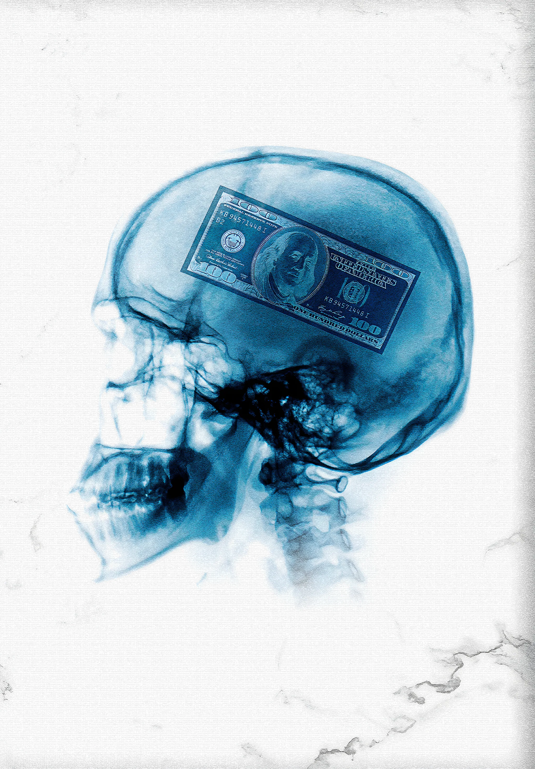 X-Ray Art | Human Skull & Dollar | Modern Money Mindset - Image 4